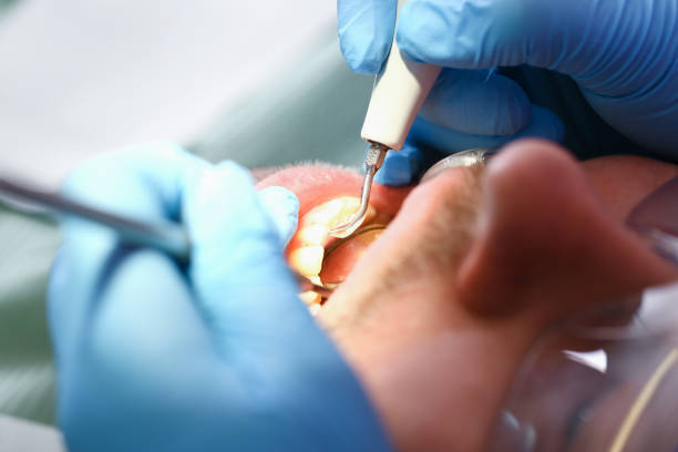 Best Urgent Care for Lost Fillings or Crowns in Park Hills, MO